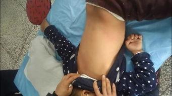 揪痧在线视频,轻松掌握家庭养生新技能